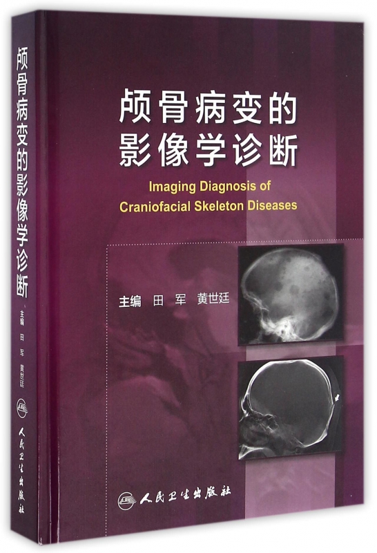颅骨病变的影像学诊断(精)