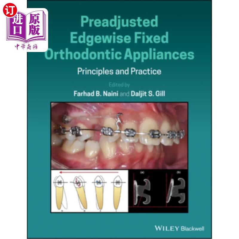 海外直订医药图书Preadjusted Edgewise Fixed Orthodontic Appliances: Principles and Prac 预调整边缘固定正畸器械:原理与实践怎么样,好用不?