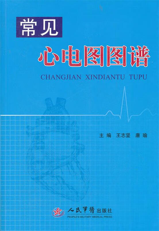 常见心电图图谱