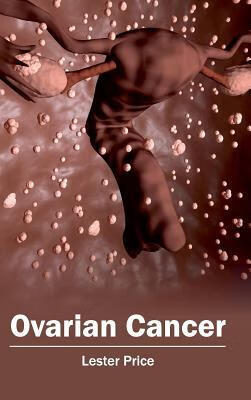 预订Ovarian Cancer