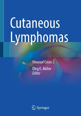 预订cutaneous lymphomas