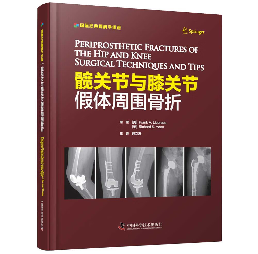 髋关节与膝关节假体周围骨折