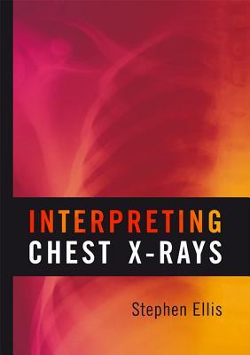 预订Interpreting Chest X-Rays