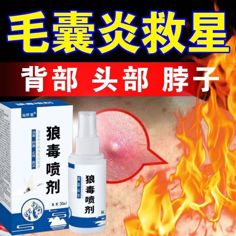 仙怀堂头皮毛囊炎狼毒喷雾剂头部背部痘痘红肿皮肤瘙痒脓包疙瘩痤l疮