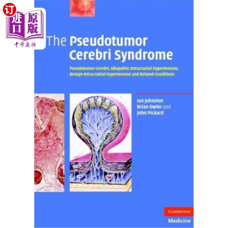 海外直订医药图书the pseudotumor cerebri syndrome: pseudotumor