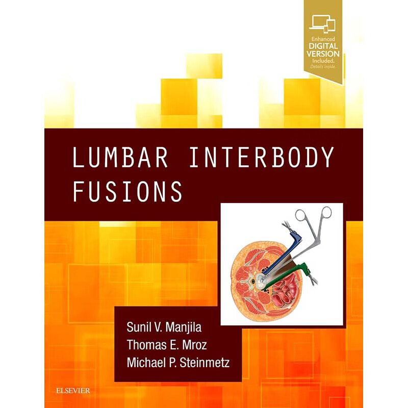 预定lumbar interbody fusions腰椎椎体融合
