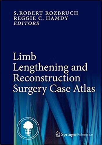 预订Limb Lengthening and Reconstruction Surgery Case