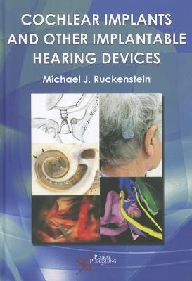 预订Cochlear Implants and Other Implantable Hearing