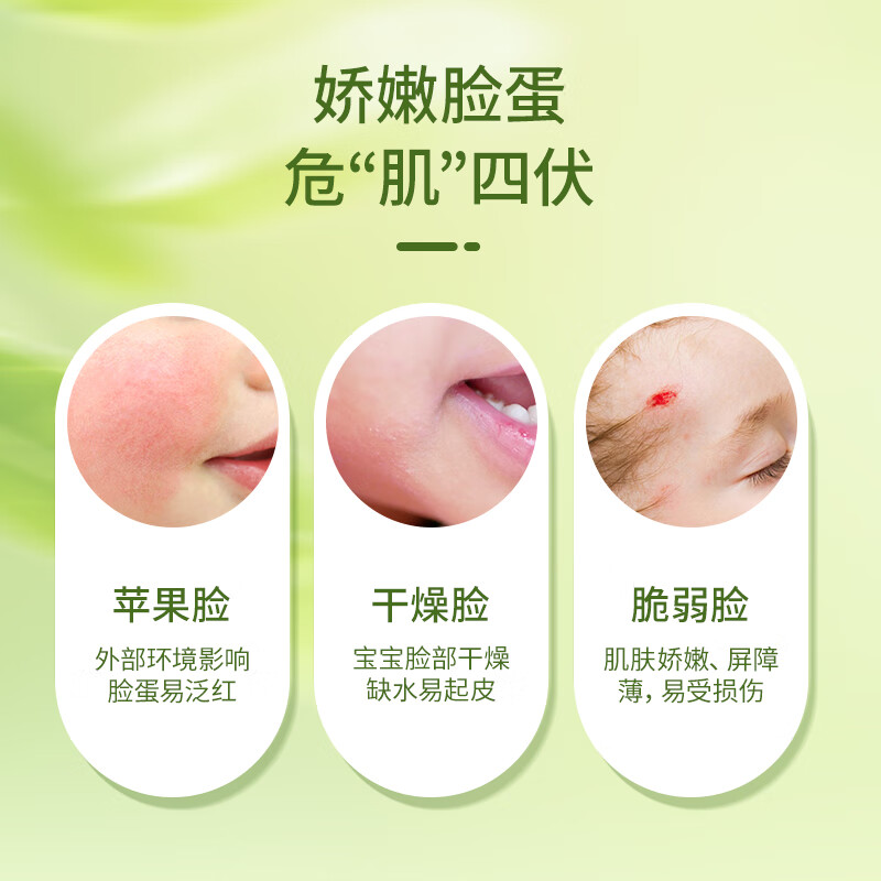 KoalaMan考拉侠澳洲进口金盏花面霜婴童宝宝霜温和滋润保湿润肤植物萃取 金盏花保湿霜50g/瓶