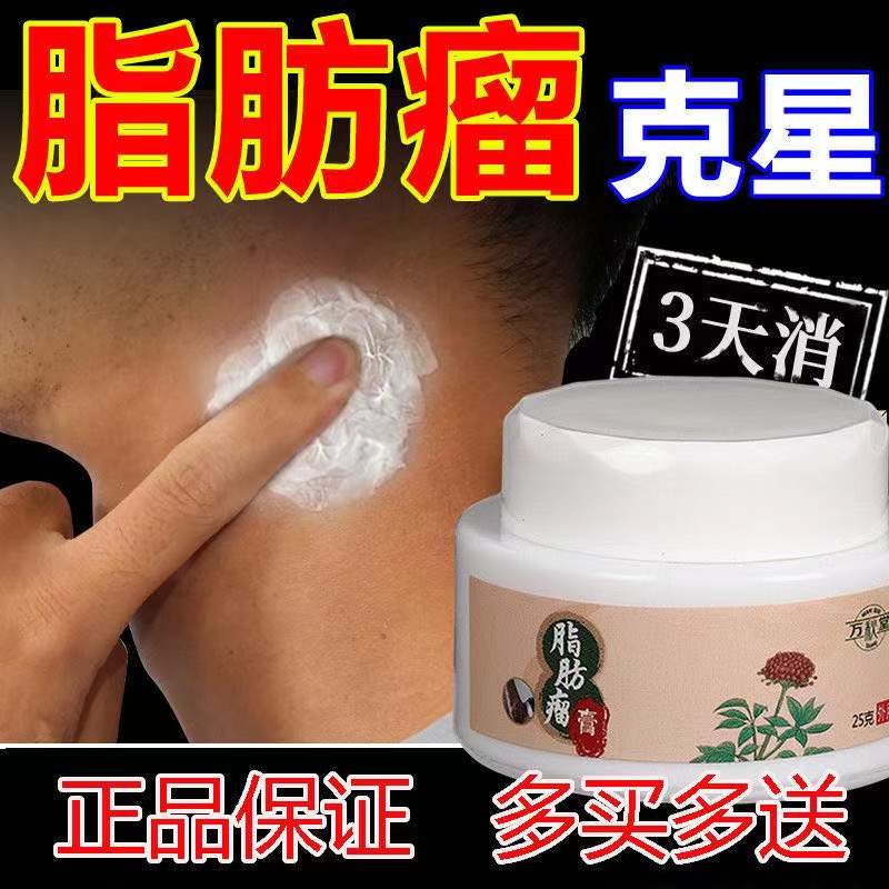 【重度脂肪瘤克星】去除皮下包块发性多发性硬块肿块凸起消膏专用 两
