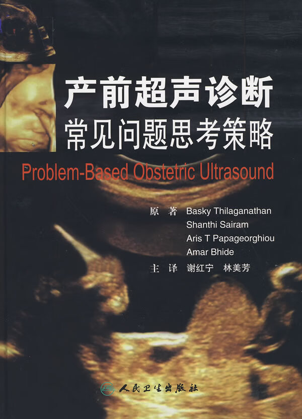 产前超声诊断常见问题思考策略【放心选购】