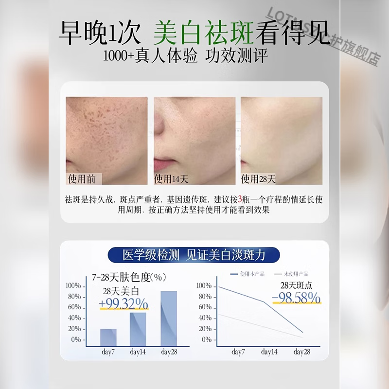 LQTMSZ纯中药霜祛斑早晚霜黄褐斑晒斑雀斑黑色素 三瓶巩固，拒绝反弹 纯中药霜