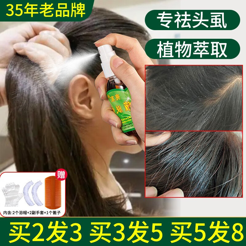 亮友祛虱子儿童头虱小女孩长头发百部酊虱子阴虱卵喷雾液虱立净喷剂