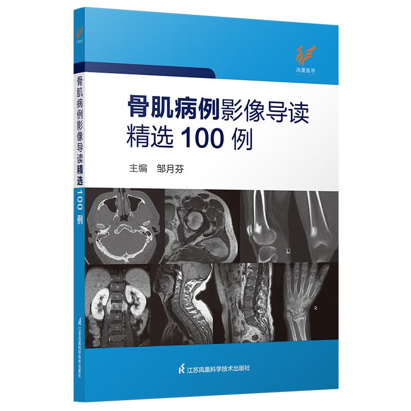 骨肌病例影像导读精选100例