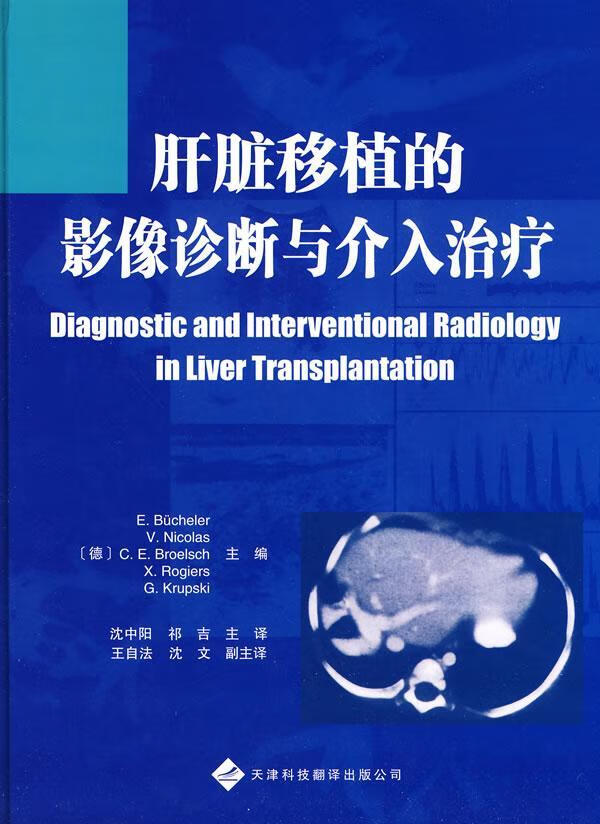 肝脏移植的影像诊断与介入 布彻勒 医学 9787543323100