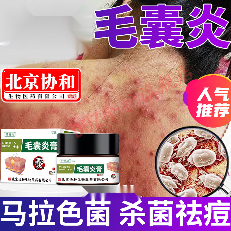 熏姿颜高野毛囊炎康灵官方舰旗店北阿米毛净康宫脸上痘痘头部后背痒