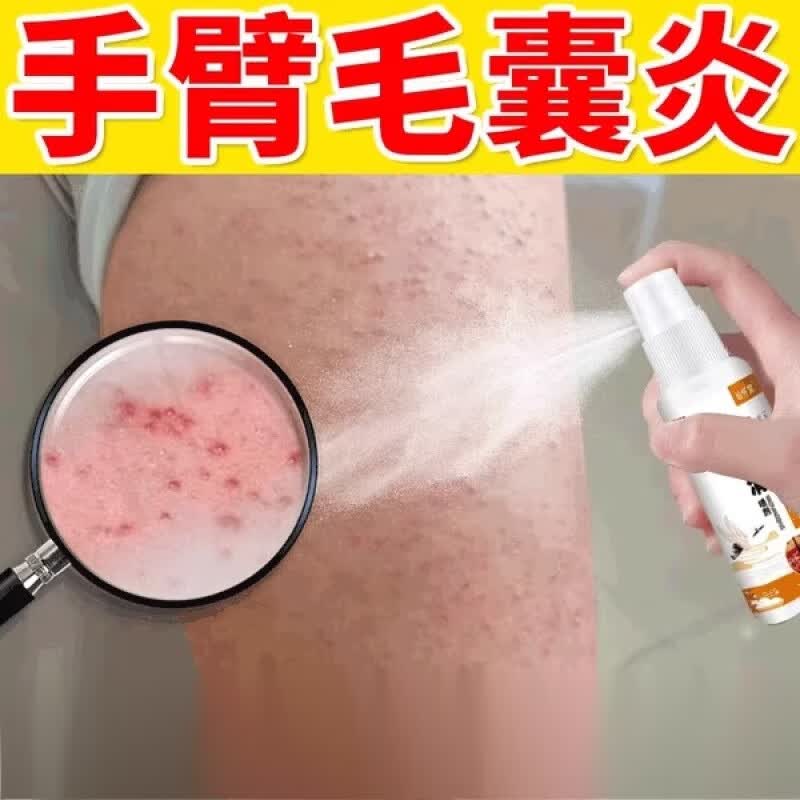 beiyvs去鸡皮肤毛囊炎磨砂膏手臂长痘痘痤疮胳膊小疙瘩喷剂真菌身体