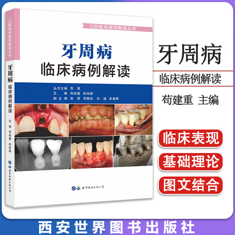 牙周病临床病例解读 口腔临床病例解读丛书 苟建重等著 牙周病案分析临床牙周病学牙龈病 西安世界图书出版公司 9787519275808