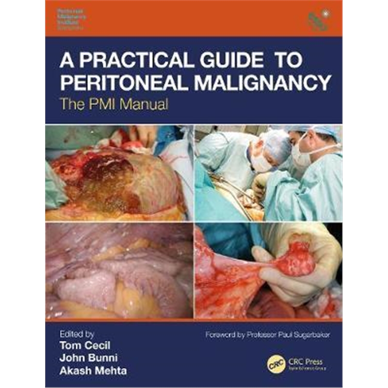 预订a practical guide to peritoneal malignancy:the