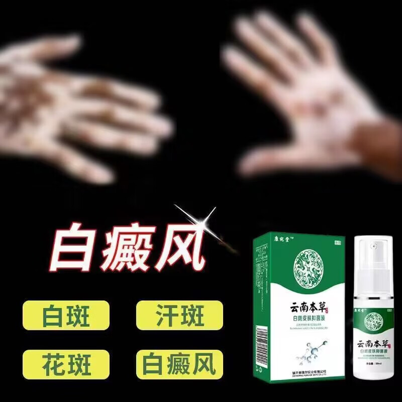 京胜白癜风去l白斑克星促l黑l色素补骨脂酊汗l斑专用喷剂 单盒装