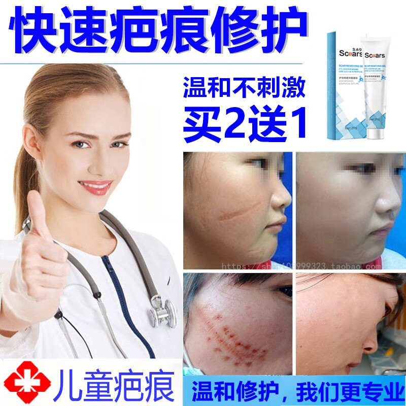 痕小孩去除伤疤痕修复膏祛淡化凹陷印指甲抓伤儿童脸部