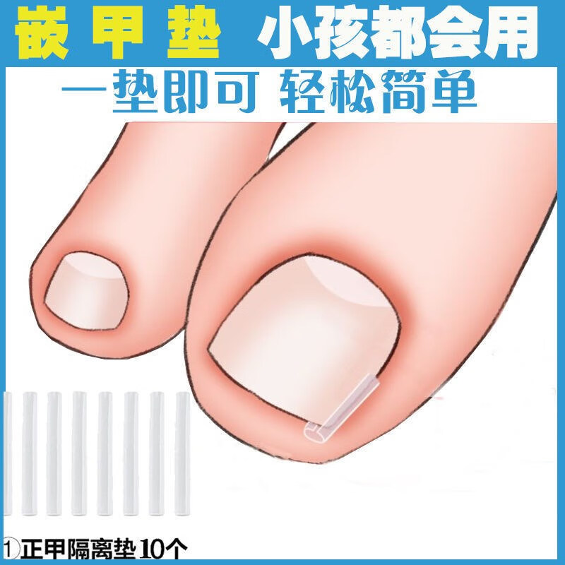 指甲矫正贴片正甲贴嵌甲矫正器甲沟矫正贴片甲沟炎神器嵌甲指甲矫正器