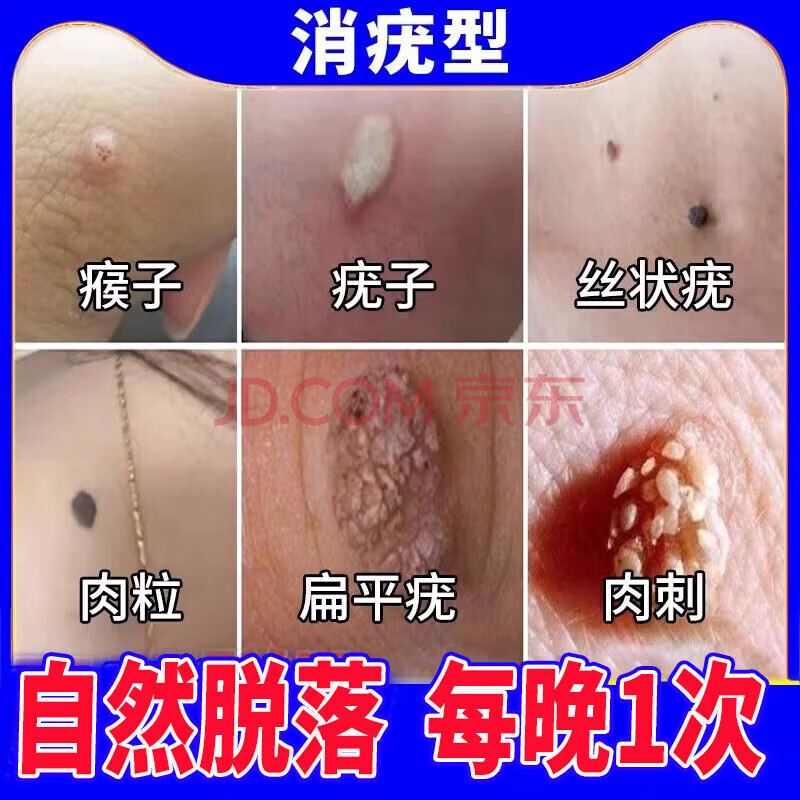 专用otc药扁平疣膏 面部脖子去猴子小肉粒疙瘩尤体丝