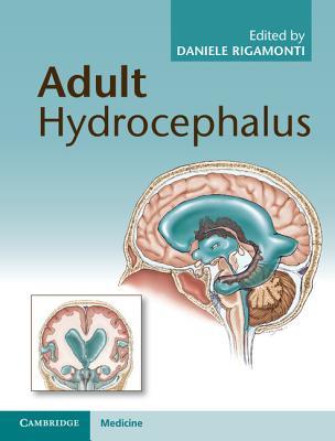 预订 高被引adult hydrocephalus