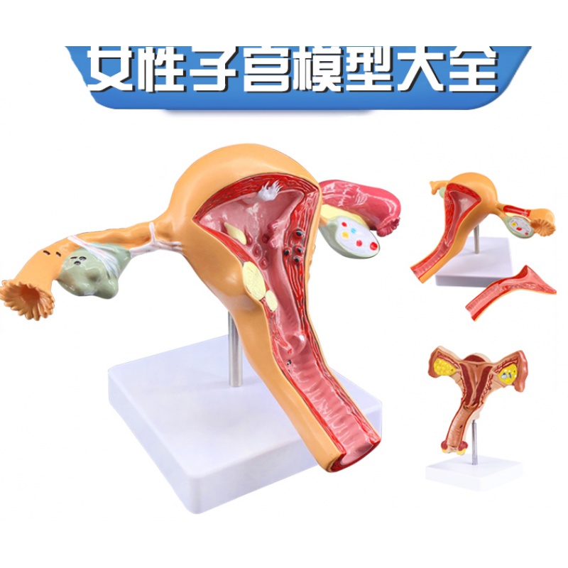 女性子宫模型内生殖器官结构解剖人体教学病理卵巢学校用 卵巢子宫
