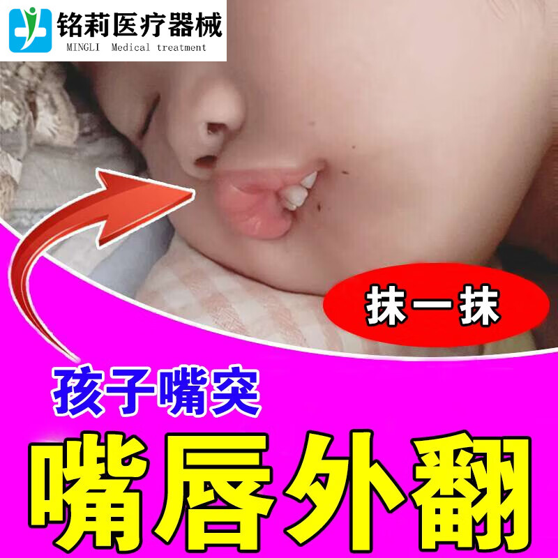 宝宝咬下嘴唇专用软膏防咬嘴唇神器矫正睡觉张嘴呼吸嘴唇外翻嘴凸 单