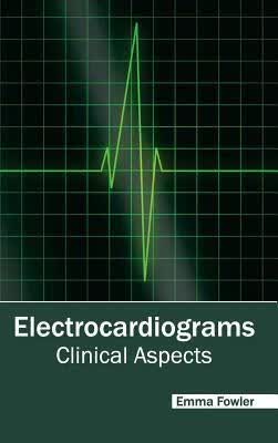 预订Electrocardiograms: Clinical Aspects