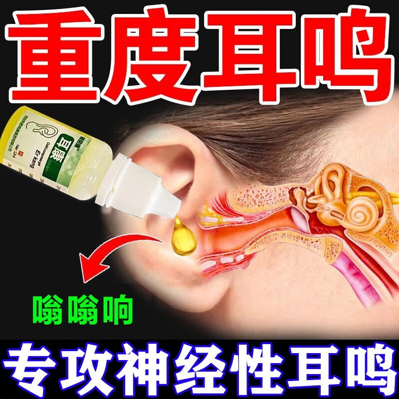 声治耳鸣神器耳鸣贴98%成功耳聋耳鸣成人儿童老年人神经性耳鸣进口 一