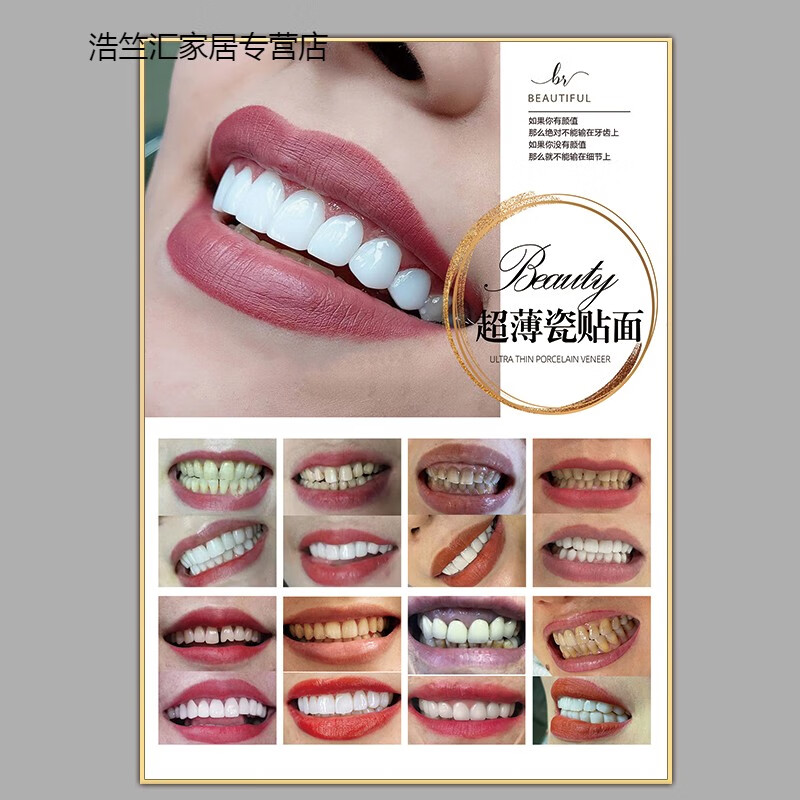 以琛超薄瓷贴面海报牙贴面挂画牙齿美白宣传画纳米炫齿冰瓷美牙广告图
