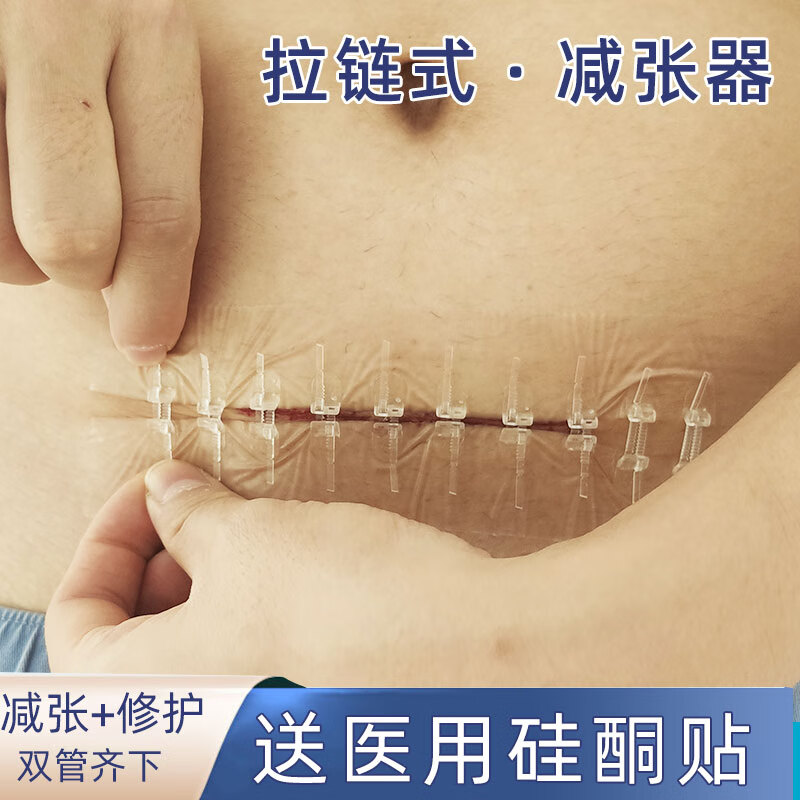 拉链式减张器外伤/剖腹产手术等-伤口免缝合减张贴 红色