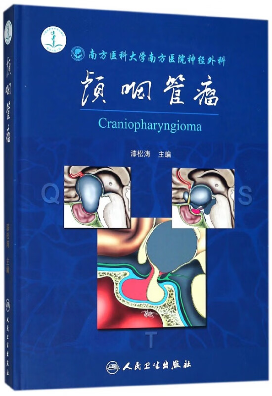 颅咽管瘤(精)
