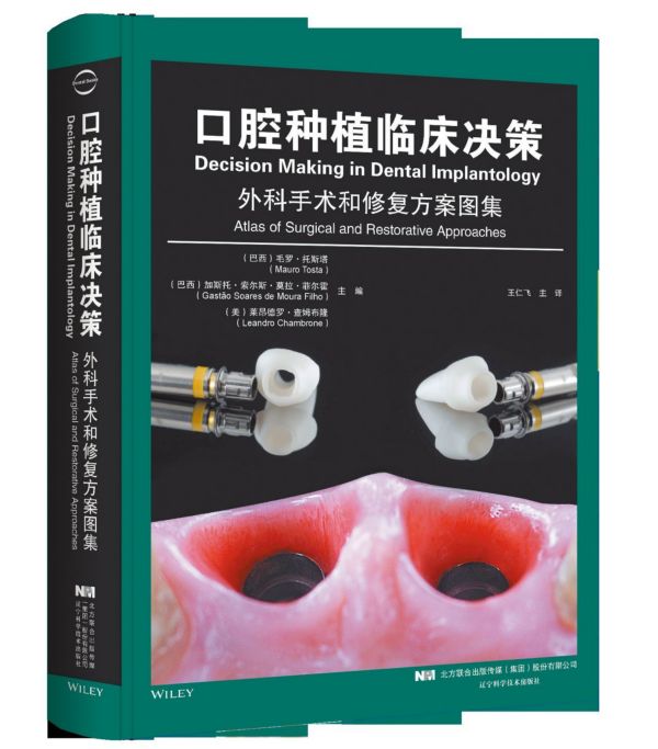 口腔种植临床决策(外科手术和修复方案图集)(精)
