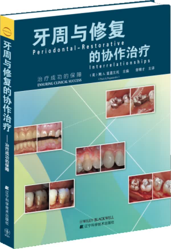 牙周与修复的协作治疗