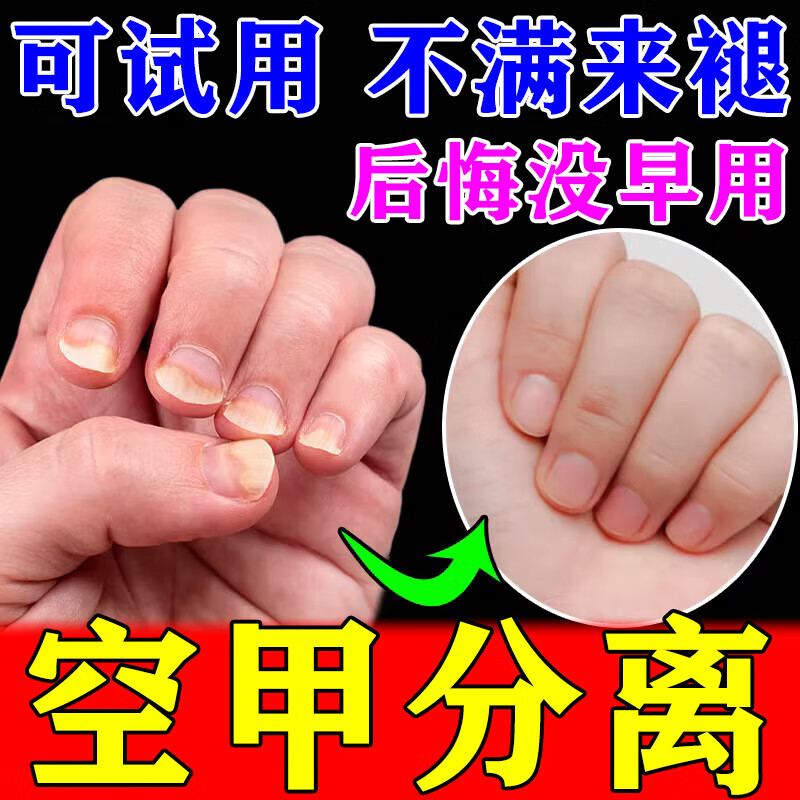 久木堂指甲甲肉分离修复空甲甲床分离肉包甲矫正手脚指甲变空增厚修复