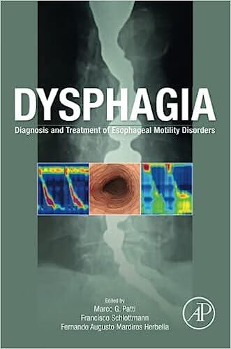 预订 dysphagia: diagnosis and treatment of esophageal motility