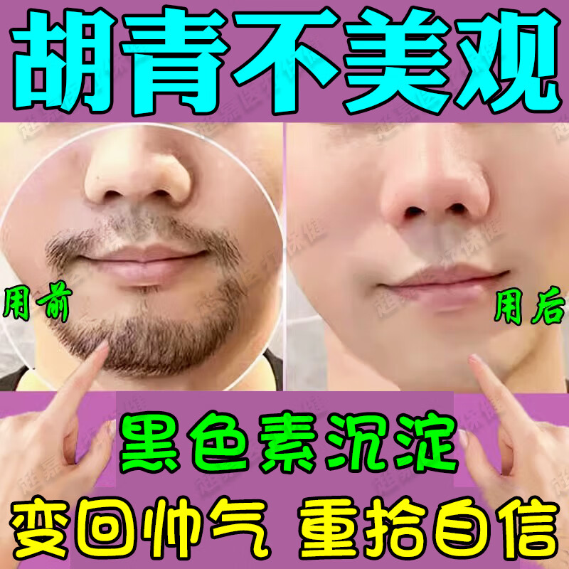胡青去除胡子黑印男士专用去胡青淡化膏脱胡子膏男去胡根黑印胡茬 单