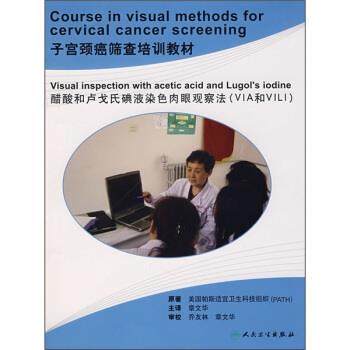 子宫颈癌筛查培训教材