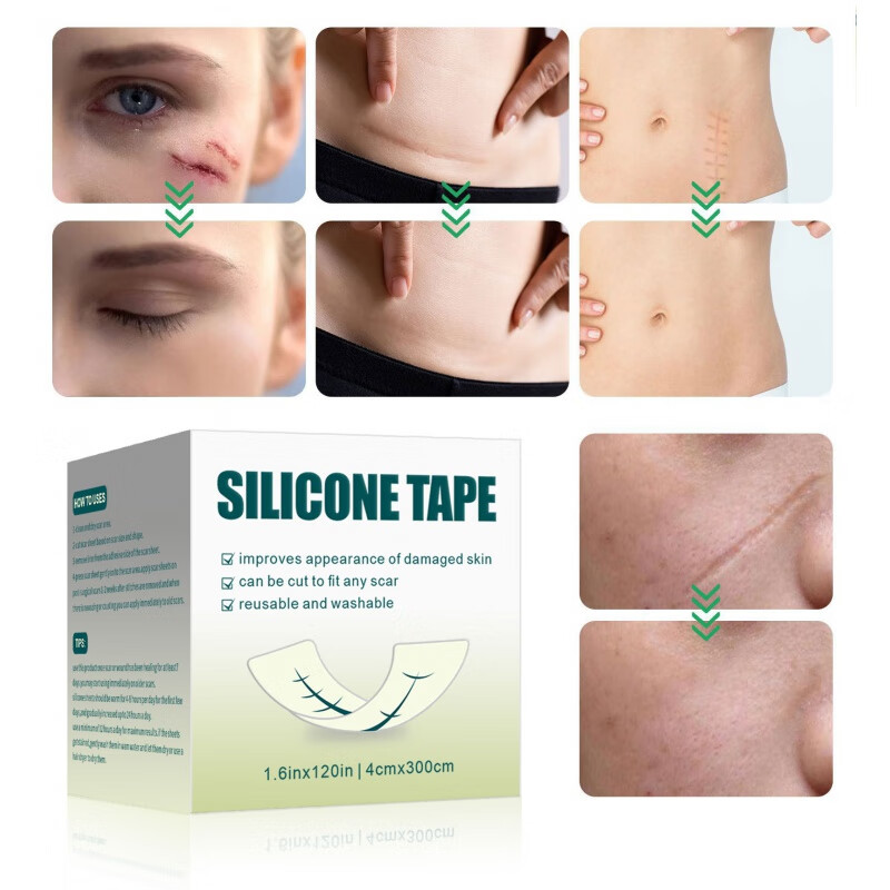 贴大尺寸贴疤痕卷隐形修护增隐形遮瑕贴疤痕遮盖修护美容贴4×300cm