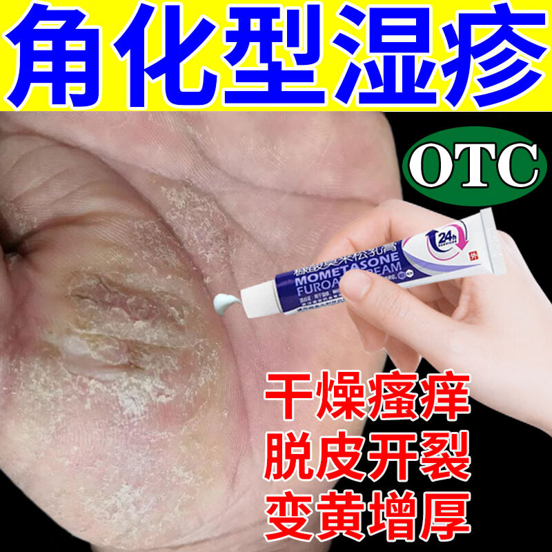 手部角化型慢性湿疹药膏】手指手掌皮肤瘙痒干燥粗糙硬块皲裂真菌感染