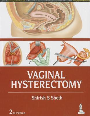 预订vaginal hysterectomy