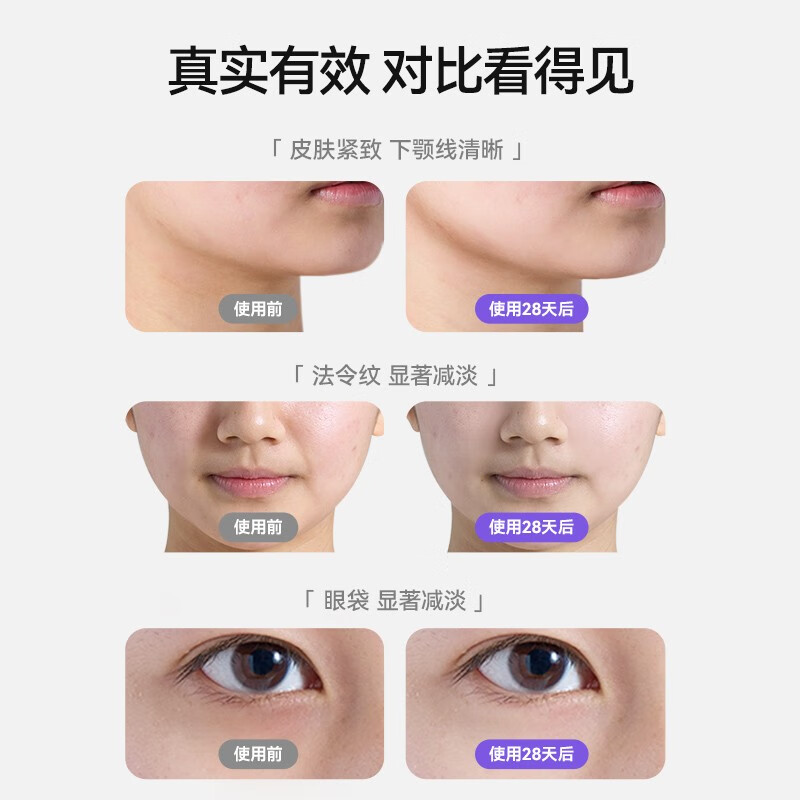 UAGOS尤加西美容仪器脸部眼部按摩仪提拉紧致家用清洁导出导入仪光子嫩肤生日情人礼物送老婆女友 元气黄