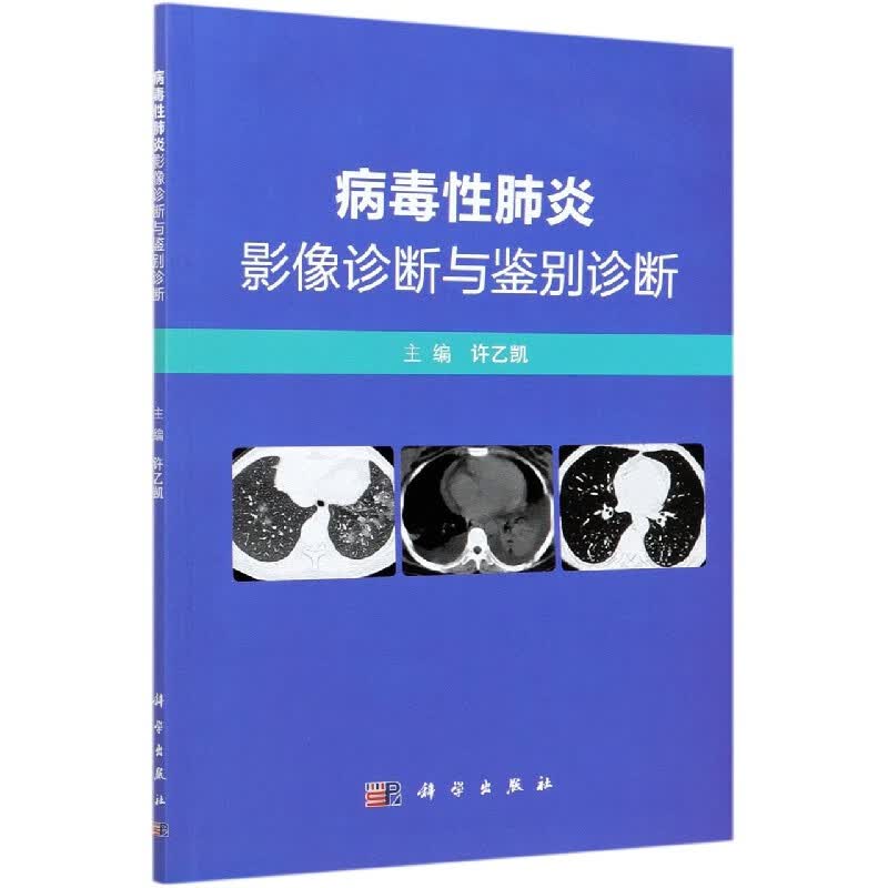 病毒性肺炎影像诊断与鉴别诊断