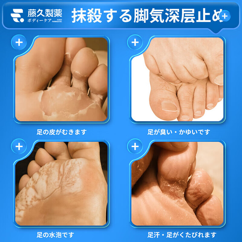 藤久制药脚气喷剂瘙痒真菌感染脚臭脚痒脚汗水泡脚喷雾 脚气喷剂+抑菌膏