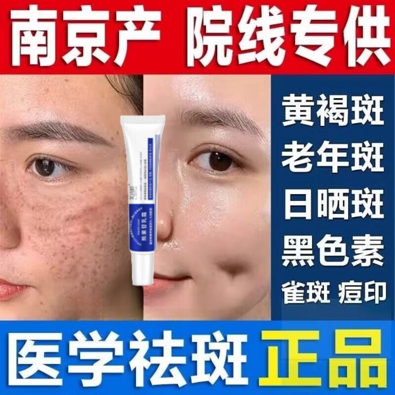 南京皮肤研究所复方熊果苷乳膏非医用烟酰i胺凝胶缓解黑色素淡斑面霜