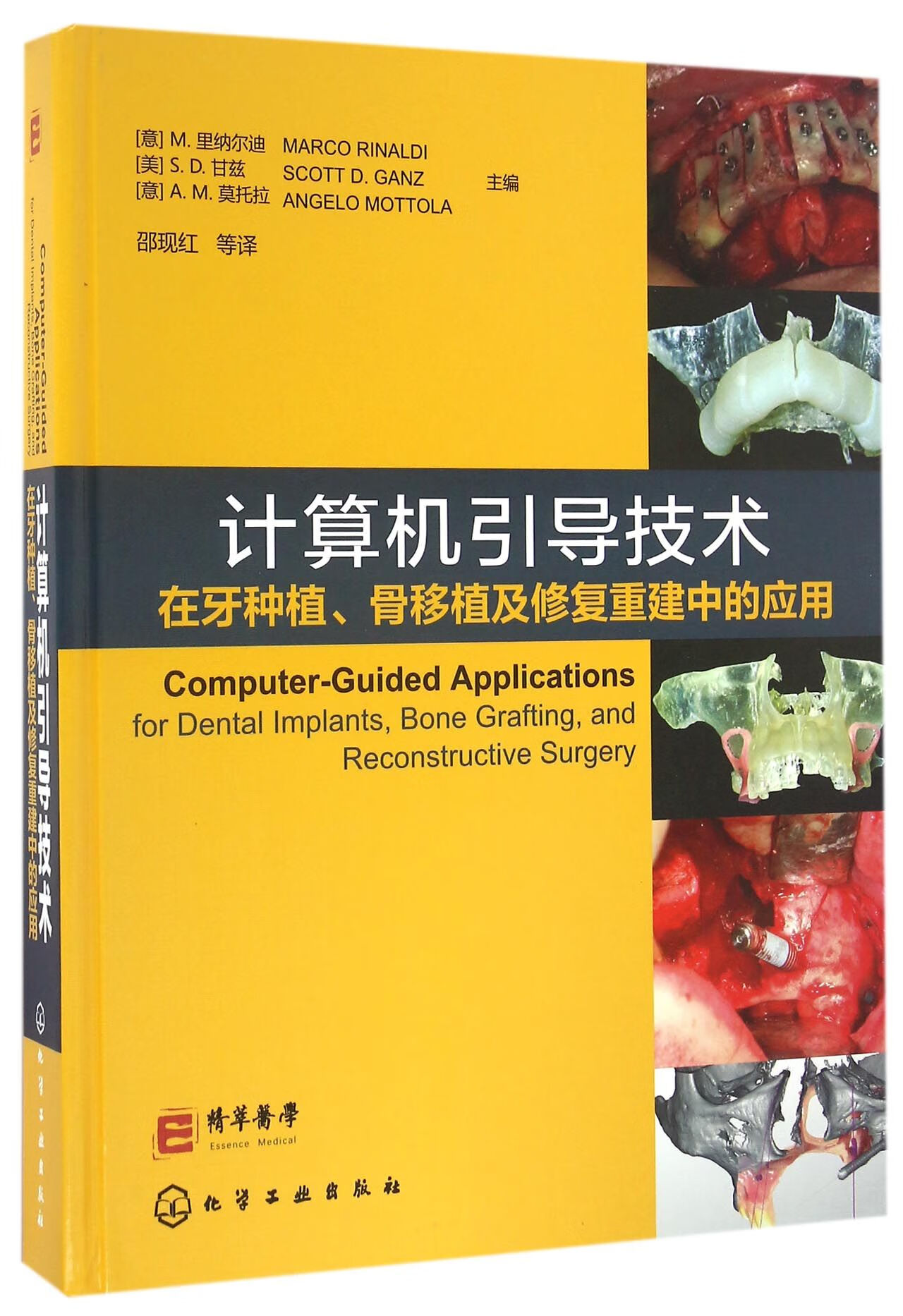 计算机引导技术在牙种植骨移植及修复重建中的应用(精) 9787122277305