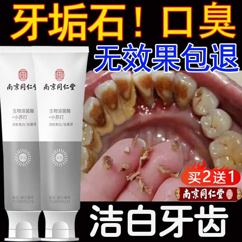 UNIO南京同仁堂小苏打牙膏去牙渍茶烟渍口臭牙垢牙斑清洁异味口气100g使用感如何?